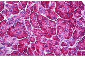 Human Pancreas: Formalin-Fixed, Parraffin-Embedded (FFPE) (Ferredoxin Reductase 抗体)