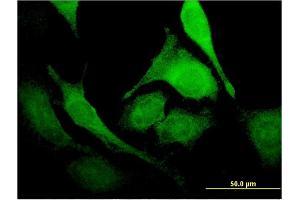 Immunofluorescence of monoclonal antibody to PUS1 on HeLa cell. (PUS1 抗体  (AA 1-399))