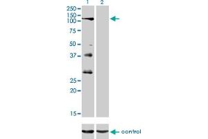 Western blot analysis of PTPRN2 over-expressed 293 cell line, cotransfected with PTPRN2 Validated Chimera RNAi (Lane 2) or non-transfected control (Lane 1). (PTPRN2 抗体  (AA 108-212))