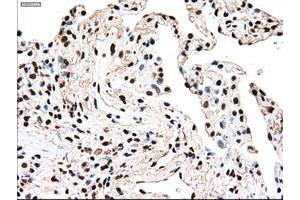 Image no. 7 for anti-TYRO3 Protein Tyrosine Kinase (TYRO3) antibody (ABIN1501605)