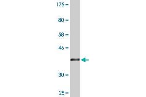 Western Blot detection against Immunogen (36. (CRYbA4 抗体  (AA 96-195))