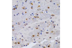 Immunohistochemistry of paraffin-embedded mouse brain using TFF1/pS2 antibody (ABIN3015565, ABIN3015566, ABIN3015567 and ABIN6218896) at dilution of 1:200 (40x lens). (TFF1 抗体  (pSer2))