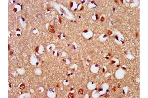 IHC image of ABIN7169728 diluted at 1:400 and staining in paraffin-embedded human brain tissue performed on a Leica BondTM system. (SIM2 抗体  (AA 347-433))
