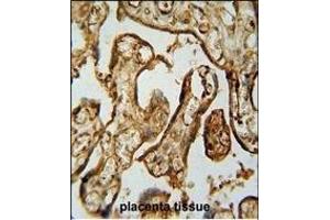 Immunohistochemistry (Paraffin-embedded Sections) (IHC (p)) image for anti-Membrane Protein, Palmitoylated 1, 55kDa (MPP1) (AA 301-327) antibody (ABIN654665)
