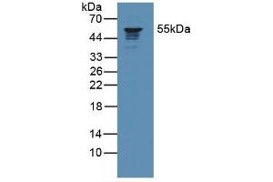 Detection of CORO1A in Human Jurkat Cells using Polyclonal Antibody to Coronin 1A (CORO1A) (Coronin 1a 抗体  (AA 7-204))