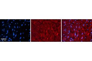 Immunohistochemistry (IHC) image for anti-ZFP36 Ring Finger Protein-Like 1 (ZFP36L1) (Middle Region) antibody (ABIN2780624)