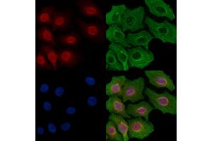 ABIN6257887 and ABIN6274270 staining Hela cells by IF/ICC. (ETV1 抗体  (N-Term))