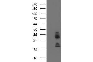 Western Blotting (WB) image for anti-Immunoglobulin J Polypeptide, Linker Protein For Immunoglobulin alpha and mu Polypeptides (IGJ) antibody (ABIN1498836) (IGJ 抗体)
