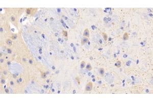 Detection of PR3 in Mouse Cerebrum Tissue using Polyclonal Antibody to Proteinase 3 (PR3) (PRTN3 抗体  (AA 24-249))