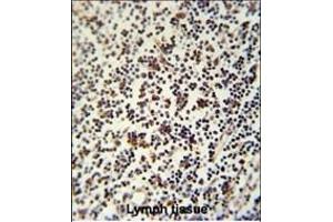 Immunohistochemistry (Paraffin-embedded Sections) (IHC (p)) image for anti-Lymphocyte-Specific Protein 1 (LSP1) (AA 108-134) antibody (ABIN651634)