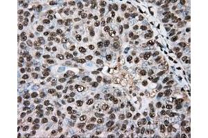 Immunohistochemical staining of paraffin-embedded colon tissue using anti-BSG mouse monoclonal antibody. (CD147 抗体)