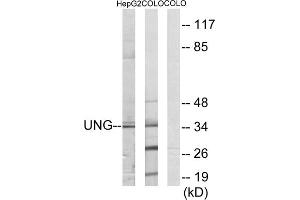 Western blot analysis of extracts from HepG2 cells and COLO cells, using UNG antibody. (UNG 抗体  (Internal Region))