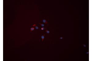 ABIN6276446 staining HEPG2 cells by ICC/IF. (Hexokinase 2 抗体  (C-Term))