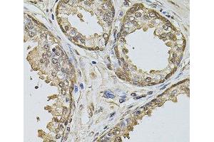 Immunohistochemistry of paraffin-embedded Human prostate using Cyclin A2 Polyclonal Antibody at dilution of 1:100 (40x lens). (Cyclin A 抗体)