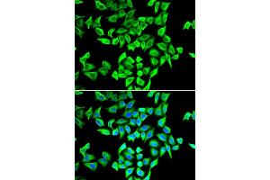 Immunofluorescence analysis of A549 cells using TP53 antibody. (p53 抗体  (AA 1-110))