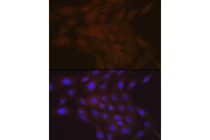 Immunofluorescence analysis of C6 cells using SMC4 Rabbit mAb (ABIN7270618) at dilution of 1:100 (40x lens). (SMC4 抗体)