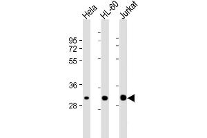Lane 1: HeLa, Lane 2: HL-60, Lane 3: Jurkat cell lysate (20µg) probed with bsm-51309M CDK2 (1534CT665. (CDK2 抗体)
