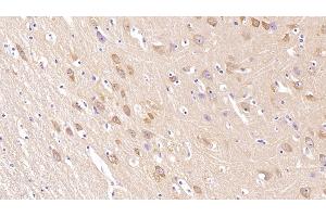 Detection of NRGN in Human Cerebrum Tissue using Monoclonal Antibody to Neurogranin (NRGN) (Neurogranin 抗体  (AA 1-67))