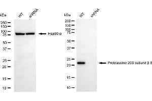 Western blotting analysis using proteasome 20S subunit beta 8 antibody (ABIN7799956).