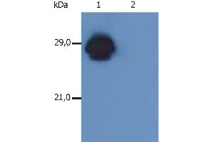 Western Blotting analysis of MHC Class II in whole cell lysate of RAJI human Burkitt lymphoma cell line using anti-human HLA-DR+DP (MEM-136). (HLA-DP/DR 抗体  (Biotin))