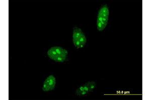 Immunofluorescence of monoclonal antibody to PELP1 on HeLa cell. (PELP1 抗体  (AA 337-410))