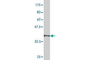 Western Blot detection against Immunogen (36. (BTG2 抗体  (AA 59-158))