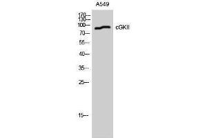 Western Blotting (WB) image for anti-Protein Kinase, CGMP-Dependent, Type II (PRKG2) (Ser363), (Thr359) antibody (ABIN3174374) (PRKG2 抗体  (Ser363, Thr359))