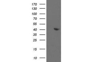 Western Blotting (WB) image for anti-Aldolase B, Fructose-Bisphosphate (ALDOB) antibody (ABIN1496605) (ALDOB 抗体)