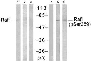 Western blot analysis of extracts using Raf-1 (Ab-259) antibody (E021006, Line 1, 2, and 3) and Raf-1 (phospho- Ser259) antibody (E011006, Line 4, 5, and 6). (RAF1 抗体)