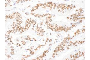 anti-Interleukin Enhancer Binding Factor 2, 45kDa (ILF2) (AA 340-390) antibody