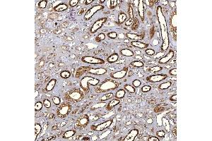 IHC analysis of PIG3/TP53I3 using anti-PIG3/TP53I3 antibody (ABIN7599280). (TP53I3 抗体  (AA 1-332))