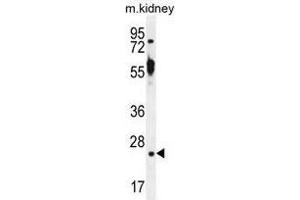 TTC9B Antibody (C-term) western blot analysis in mouse kidney tissue lysates (35 µg/lane). (TTC9B 抗体  (C-Term))