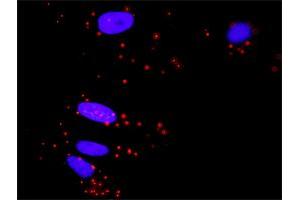 Proximity Ligation Analysis of protein-protein interactions between MAPK3 and ELK1. (ELK1 抗体  (AA 67-166))