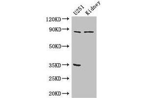Western Blot Positive WB detected in: U251 whole cell lysate, Mouse kidney tissue All lanes: RPS6KA4 antibody at 3 μg/mL Secondary Goat polyclonal to rabbit IgG at 1/50000 dilution Predicted band size: 86, 85 kDa Observed band size: 86 kDa (MSK2 抗体  (AA 237-393))