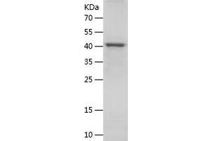 Western Blotting (WB) image for Epidermal Growth Factor Receptor (EGFR) (AA 1025-1210) protein (His-IF2DI Tag) (ABIN7122802) (EGFR Protein (AA 1025-1210) (His-IF2DI Tag))