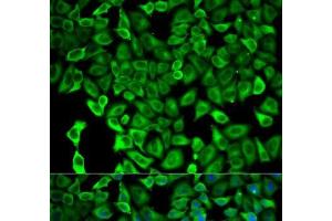Immunofluorescence analysis of HeLa cells using PSMD2 Polyclonal Antibody (PSMD2 抗体)