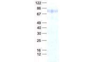 Western Blotting (WB) image for Male-Specific Lethal 2 Homolog (MSL2) protein (His tag) (ABIN2726439)
