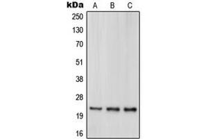 Western blot analysis of DJ-1 expression in HeLa (A), HEK293T (B), Jurkat (C) whole cell lysates. (PARK7/DJ1 抗体  (Center))