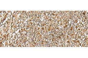 Immunohistochemistry of paraffin-embedded Human tonsil tissue using DTYMK Polyclonal Antibody at dilution of 1:70(x200) (DTYMK 抗体)