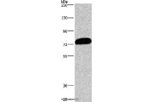 Western blot analysis of PC3 cell, using CDCP1 Polyclonal Antibody at dilution of 1:1100 (CDCP1 抗体)