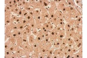 IHC-P Image Transaldolase antibody detects TALDO1 protein at nucleus on human hepatoma by immunohistochemical analysis. (TALDO1 抗体  (N-Term))