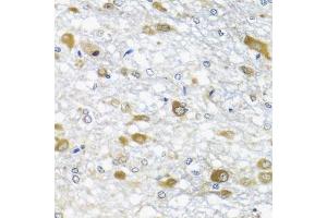 Immunohistochemistry of paraffin-embedded rat brain using DDX39A antibody (ABIN6131590, ABIN6139489, ABIN6139491 and ABIN6223963) at dilution of 1:100 (40x lens).