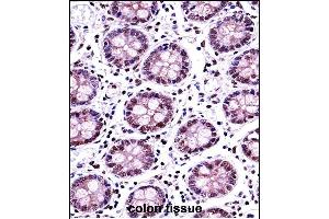 TERF2 Antibody (Center) ((ABIN657781 and ABIN2846755))immunohistochemistry analysis in formalin fixed and paraffin embedded human colon tissue followed by peroxidase conjugation of the secondary antibody and DAB staining. (TRF2 抗体  (AA 308-337))