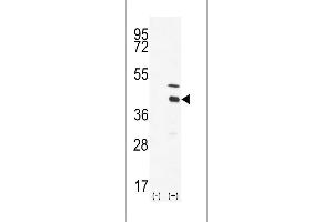 Western blot analysis of DOK4 using DOK4 Antibody using 293 cell lysates (2 ug/lane) either nontransfected (Lane 1) or transiently transfected with the DOK4 gene (Lane 2). (DOK4 抗体  (C-Term))