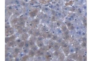 Immunohistochemistry (IHC) image for anti-Solute Carrier Family 25 (Carnitine/acylcarnitine Translocase), Member 20 (SLC25A20) (AA 1-211) antibody (ABIN7433891)