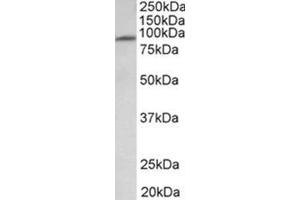 AP31934PU-N MFSD6 antibody staining of Human Heart lysate at 1 µg/ml (35µg protein in RIPA buffer). (MFSD6 抗体  (Extracellular Domain))