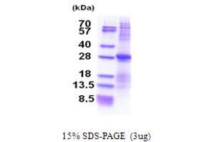 ATP1B3 Protein (AA 57-279) (His tag)