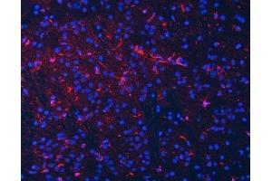 anti-Septin 2 (SEPT2) (AA 1-326) antibody