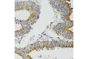 Immunohistochemistry (IHC) image for anti-Mitochondrially Encoded NADH Dehydrogenase 5 (MT-ND5) (AA 500-600) antibody (ABIN6144435)