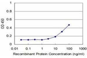 Detection limit for recombinant GST tagged RIPK4 is approximately 3ng/ml as a capture antibody. (RIPK4 抗体  (AA 675-784))